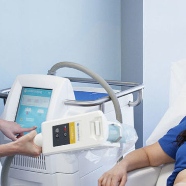 La Consulta de Coolsculpting: El Primer Paso